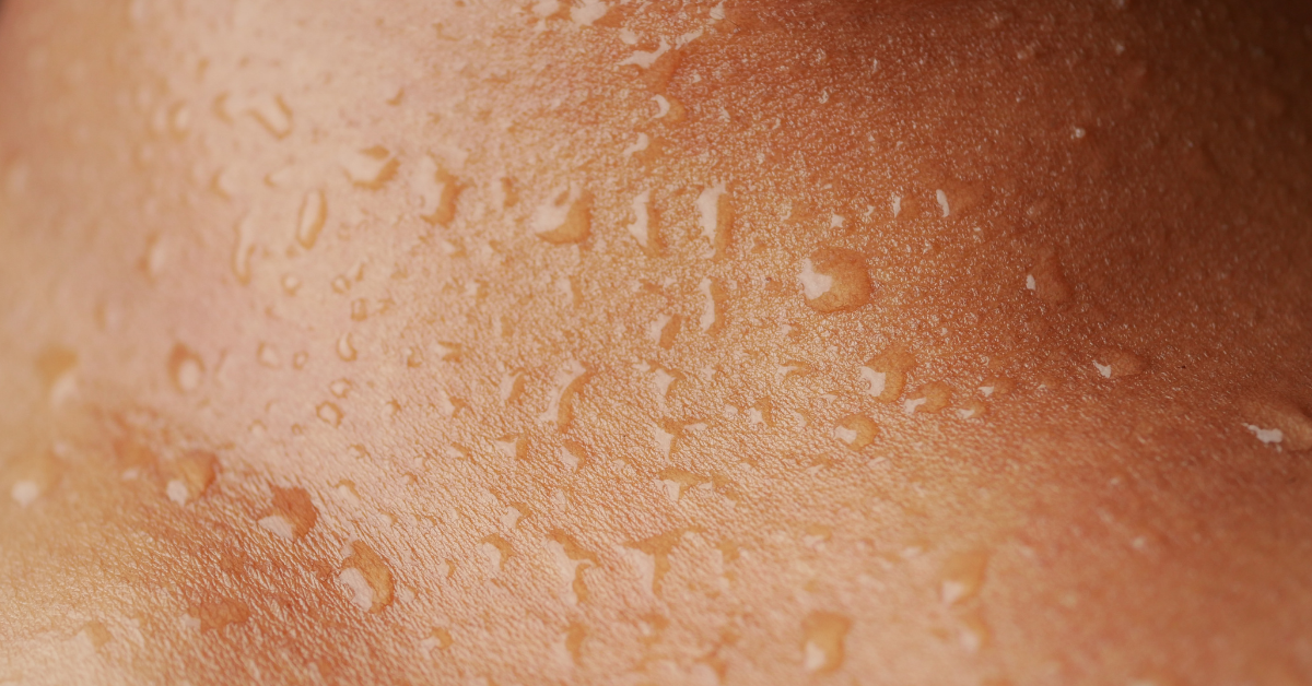 Hidratación de la piel en la rutina skincare